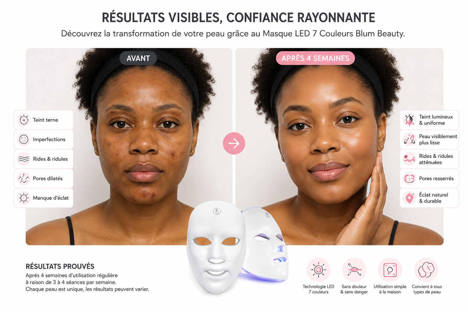 Résultat après utilisation du masque LED Blum Beauty